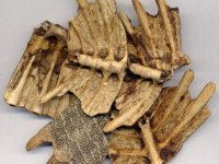 拔罐疗法的治病机理4